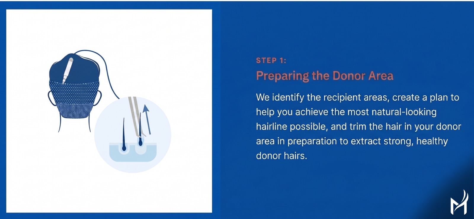 Step 1
